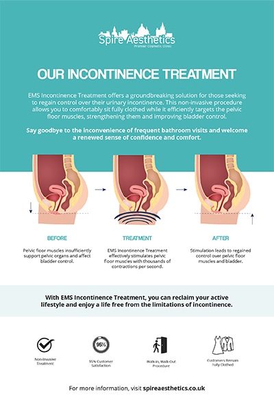 image of how urge incontinence Sale treatment works